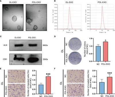 High-Metastatic Melanoma Cells Promote the Metastatic Capability of Low-Metastatic Melanoma Cells via Exosomal Transfer of miR-411-5p